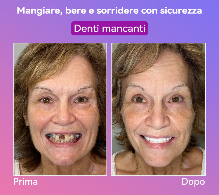 𝐉𝐚𝐬𝐬𝐞𝐞𝐦® Ultimi Dentiere Premium Comfort🎁 (Dentiere di Alta Qualità, Comode da Indossare - Sconto del 70% per un Periodo Limitato)