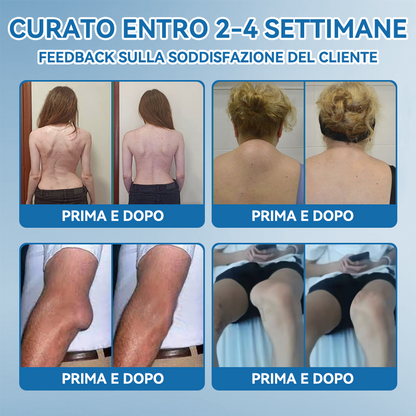 Picdo® BPC-157 Crema per la Guarigione delle Articolazioni 💕 Tratta efficacemente l’artrite, la neuropatia, il reumatismo, gli infortuni sportivi e molto altro 👩‍⚕️🏆