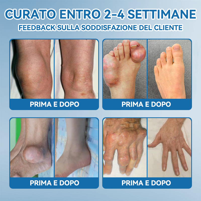 Picdo® BPC-157 Crema per la Guarigione delle Articolazioni 💕 Tratta efficacemente l’artrite, la neuropatia, il reumatismo, gli infortuni sportivi e molto altro 👩‍⚕️🏆