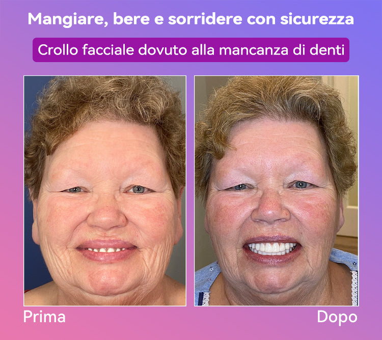 𝐉𝐚𝐬𝐬𝐞𝐞𝐦® Ultimi Dentiere Premium Comfort🎁 (Dentiere di Alta Qualità, Comode da Indossare - Sconto del 70% per un Periodo Limitato)