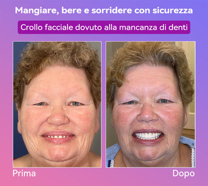 𝐉𝐚𝐬𝐬𝐞𝐞𝐦® Ultimi Dentiere Premium Comfort🎁 (Dentiere di Alta Qualità, Comode da Indossare - Sconto del 70% per un Periodo Limitato)