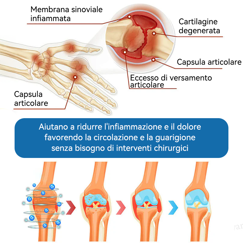 Picdo® BPC-157 Crema per la Guarigione delle Articolazioni 💕 Tratta efficacemente l’artrite, la neuropatia, il reumatismo, gli infortuni sportivi e molto altro 👩‍⚕️🏆