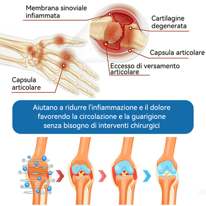 Picdo® BPC-157 Crema per la Guarigione delle Articolazioni 💕 Tratta efficacemente l’artrite, la neuropatia, il reumatismo, gli infortuni sportivi e molto altro 👩‍⚕️🏆