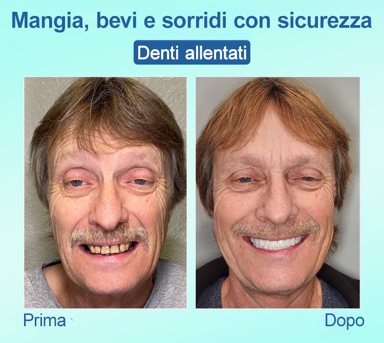 𝐉𝐚𝐬𝐬𝐞𝐞𝐦®🍀𝑃𝑟𝑜𝑡𝑒𝑠𝑖 𝐷𝑒𝑛𝑡𝑎𝑟𝑖𝑎 𝑃𝑟𝑒𝑚𝑖𝑢𝑚(🦷𝑆𝑐𝑜𝑛𝑡𝑜 𝑎 𝑡𝑒𝑚𝑝𝑜 𝑙𝑖𝑚𝑖𝑡𝑎𝑡𝑜 𝑈𝑙𝑡𝑖𝑚𝑖 30 𝑚𝑖𝑛𝑢𝑡𝑖🦷)