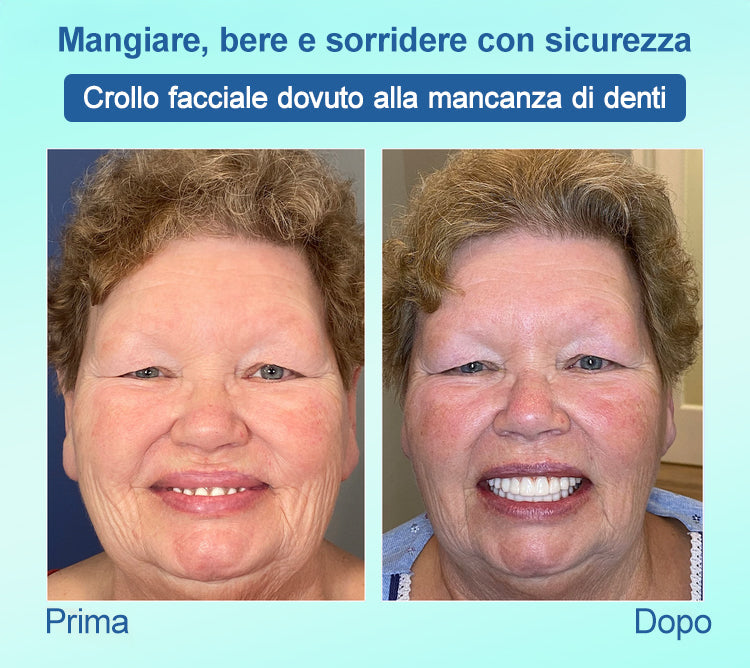 𝐉𝐚𝐬𝐬𝐞𝐞𝐦®🍀𝑃𝑟𝑜𝑡𝑒𝑠𝑖 𝐷𝑒𝑛𝑡𝑎𝑟𝑖𝑎 𝑃𝑟𝑒𝑚𝑖𝑢𝑚(🦷𝑆𝑐𝑜𝑛𝑡𝑜 𝑎 𝑡𝑒𝑚𝑝𝑜 𝑙𝑖𝑚𝑖𝑡𝑎𝑡𝑜 𝑈𝑙𝑡𝑖𝑚𝑖 30 𝑚𝑖𝑛𝑢𝑡𝑖🦷)