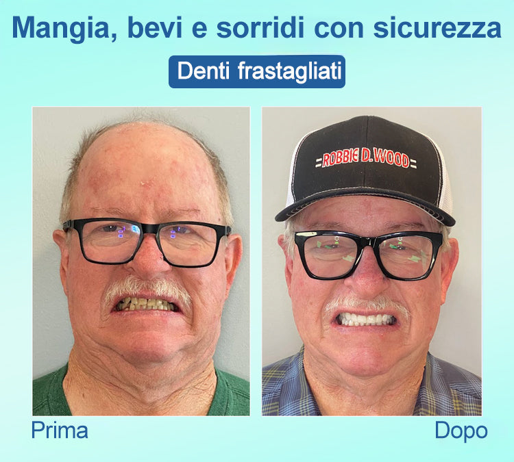𝐉𝐚𝐬𝐬𝐞𝐞𝐦®🍀𝑃𝑟𝑜𝑡𝑒𝑠𝑖 𝐷𝑒𝑛𝑡𝑎𝑟𝑖𝑎 𝑃𝑟𝑒𝑚𝑖𝑢𝑚(🦷𝑆𝑐𝑜𝑛𝑡𝑜 𝑎 𝑡𝑒𝑚𝑝𝑜 𝑙𝑖𝑚𝑖𝑡𝑎𝑡𝑜 𝑈𝑙𝑡𝑖𝑚𝑖 30 𝑚𝑖𝑛𝑢𝑡𝑖🦷)