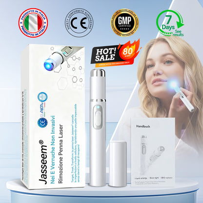 𝐉𝐚𝐬𝐬𝐞𝐞𝐦® Penna Laser Medica 🎉 (Tecnologia Laser al Carbonio – Efficace nel Rimuovere Nei, Verruche, Escrescenze Cutanee, Macchie di Pigmentazione e Altri Difetti della Pelle) 🔥