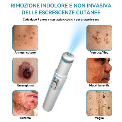𝐉𝐚𝐬𝐬𝐞𝐞𝐦® Penna Laser Medica 🎉 (Tecnologia Laser al Carbonio – Efficace nel Rimuovere Nei, Verruche, Escrescenze Cutanee, Macchie di Pigmentazione e Altri Difetti della Pelle) 🔥