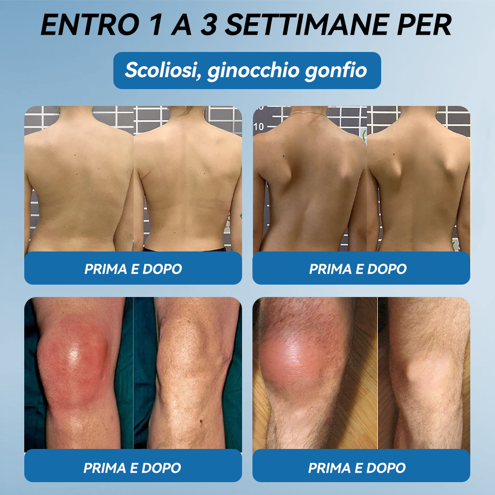 Picdo® BPC-157 Crema per la Guarigione delle Articolazioni 💕 Tratta efficacemente l’artrite, la neuropatia, il reumatismo, gli infortuni sportivi e molto altro 👩‍⚕️🏆
