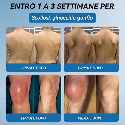 Picdo® BPC-157 Crema per la Guarigione delle Articolazioni 💕 Tratta efficacemente l’artrite, la neuropatia, il reumatismo, gli infortuni sportivi e molto altro 👩‍⚕️🏆