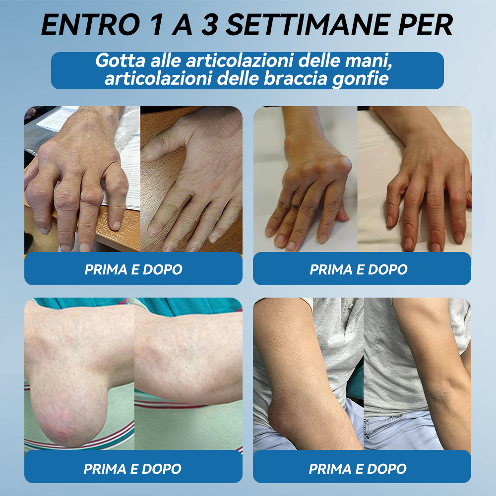 Picdo® BPC-157 Crema per la Guarigione delle Articolazioni 💕 Tratta efficacemente l’artrite, la neuropatia, il reumatismo, gli infortuni sportivi e molto altro 👩‍⚕️🏆