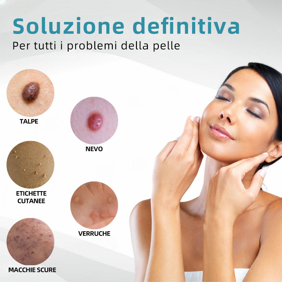 𝐉𝐚𝐬𝐬𝐞𝐞𝐦® Penna Laser Medica 🎉 (Tecnologia Laser al Carbonio – Efficace nel Rimuovere Nei, Verruche, Escrescenze Cutanee, Macchie di Pigmentazione e Altri Difetti della Pelle) 🔥
