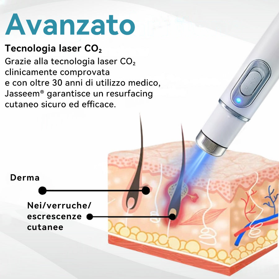 𝐉𝐚𝐬𝐬𝐞𝐞𝐦® Penna Laser Medica 🎉 (Tecnologia Laser al Carbonio – Efficace nel Rimuovere Nei, Verruche, Escrescenze Cutanee, Macchie di Pigmentazione e Altri Difetti della Pelle) 🔥